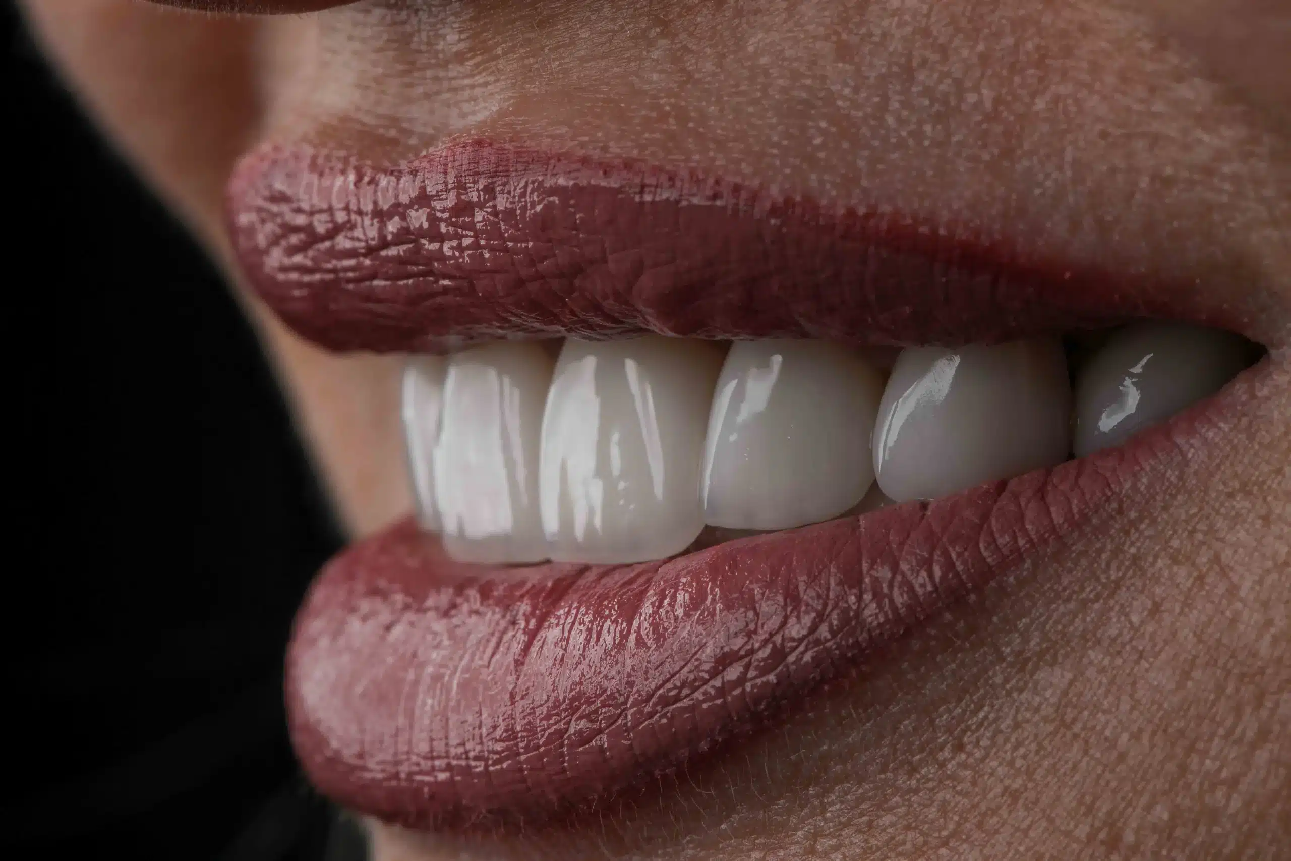 Özel Dental Center diş kliniği Gaziosmanpaşa İstanbul